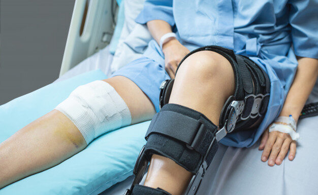 Maximum Medical Improvement: What Is It & How Does It Affect Your Injury Assessment?