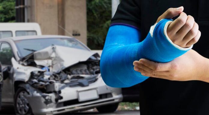 Car Accident Injury Cases: How to Resolve Your Case Faster – 2024 Guide